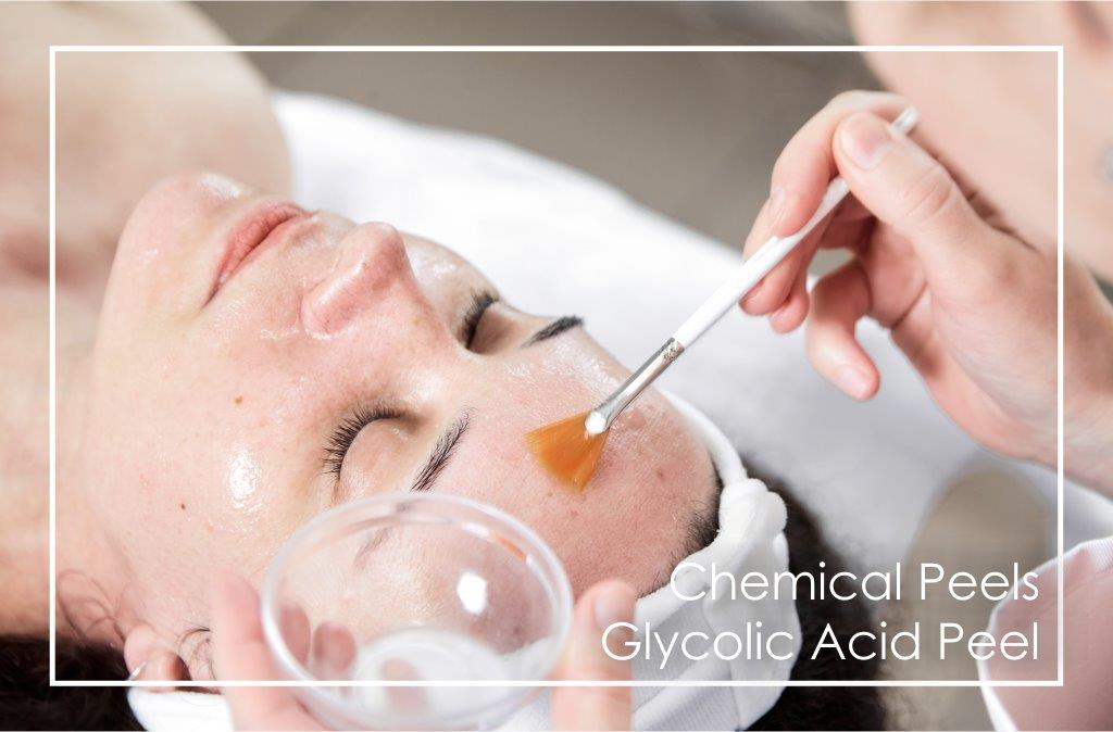 Dr Ria Smit Women's Health & Aesthetic Medicine, PaarlChemical Peel involving Glycolic acid, the treatment is performed by a trained professional