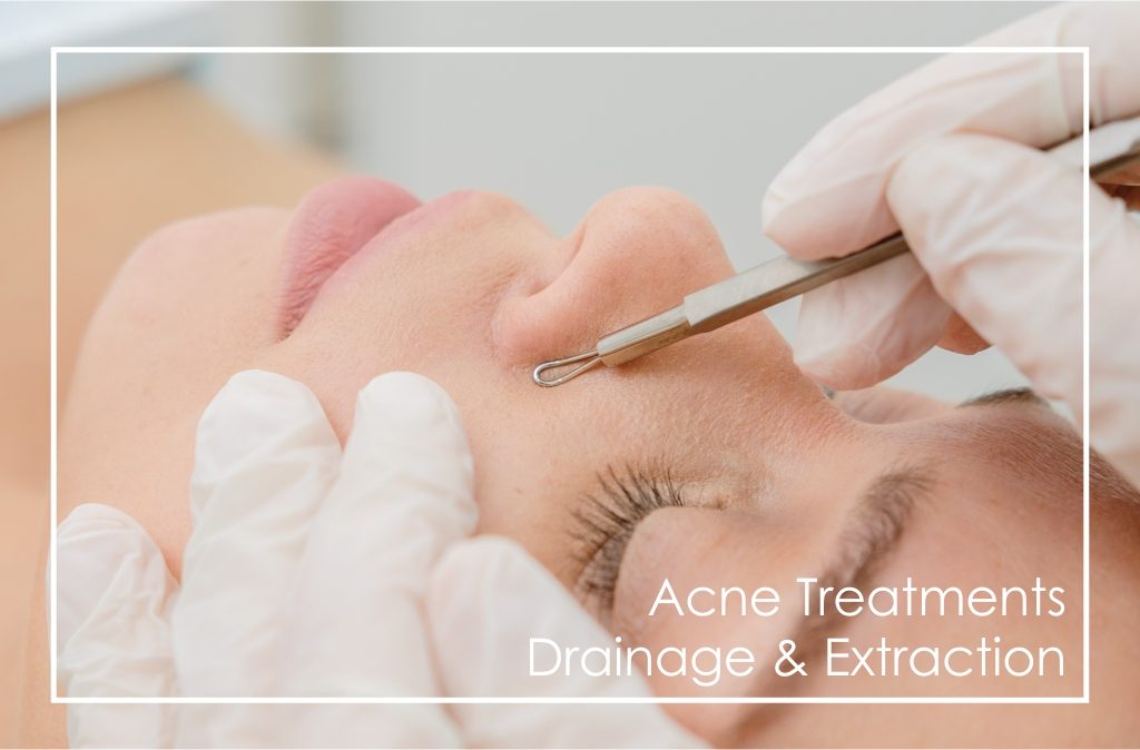 Professional Treatments For Acne questions and answers
