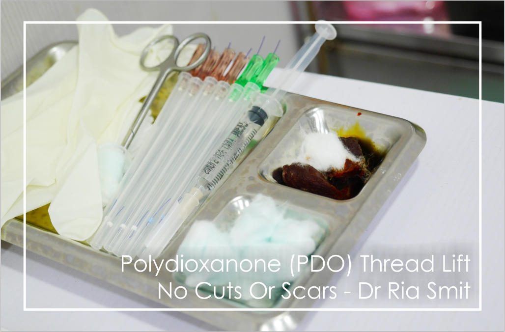 Dr Ria Smit Women's Health & Aesthetic Medicine, Paarl What Is a Polydioxanone (PDO) Thread Lift? A thread lift is a procedure that uses a dissolvable suture to tighten and lift your skin.