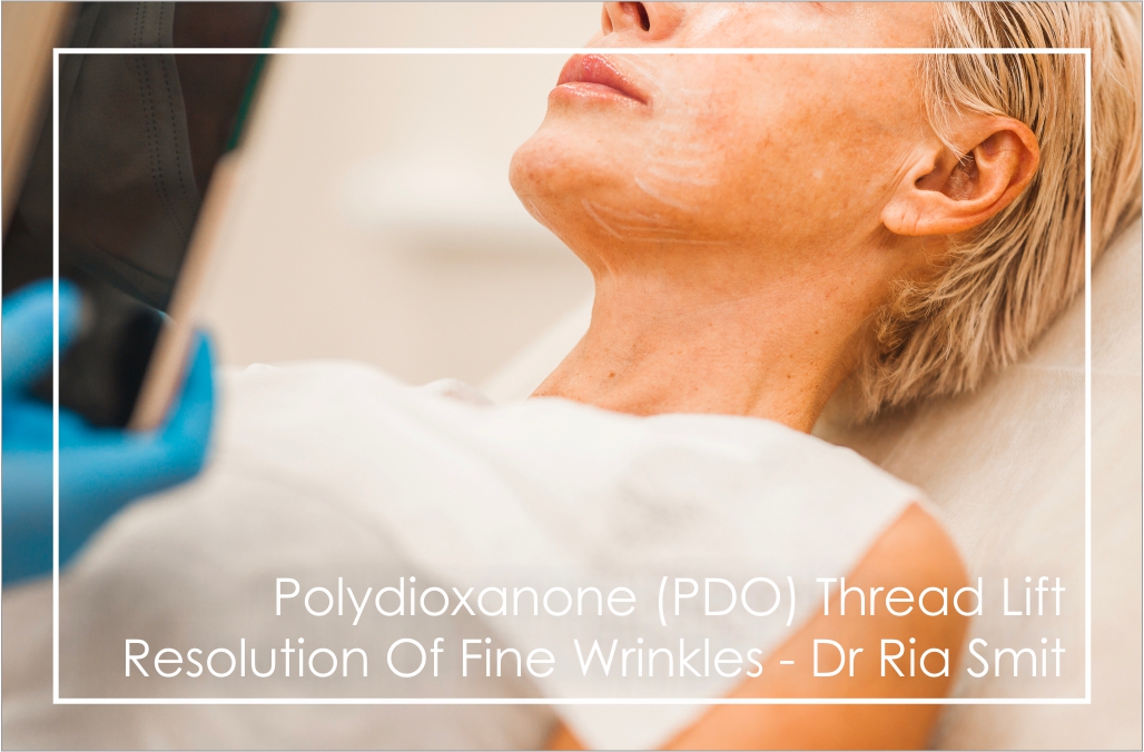 Dr Ria Smit Women's Health & Aesthetic Medicine, Paarl Polydioxanone (PDO) Thread Lift treatment smooths fine wrinkles.
